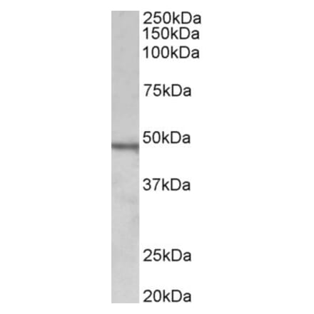 Western Blot - Anti-CHIT1 Antibody (A85008) - Antibodies.com