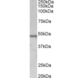 Western Blot - Anti-CHIT1 Antibody (A85008) - Antibodies.com