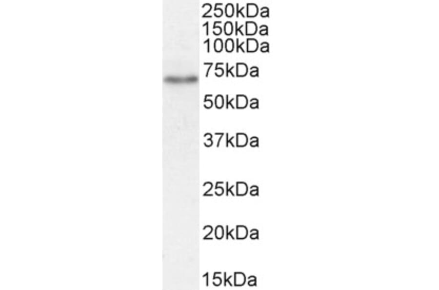 Western Blot - Anti-SGLT1 Antibody (A85010) - Antibodies.com