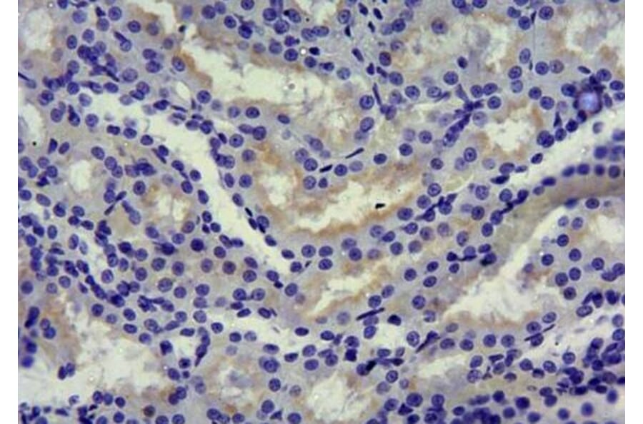 Immunohistochemistry - Anti-SGLT1 Antibody (A85010) - Antibodies.com
