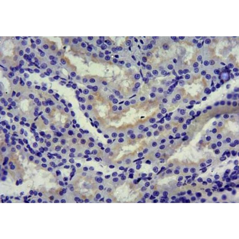 Immunohistochemistry - Anti-SGLT1 Antibody (A85010) - Antibodies.com