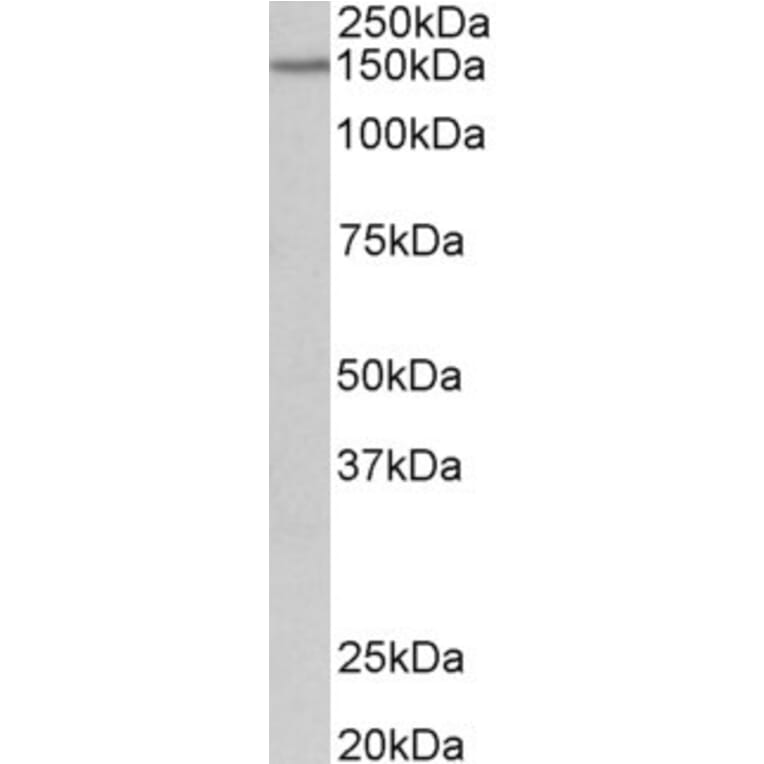 Western Blot - Anti-PCDH17 Antibody (A85011) - Antibodies.com