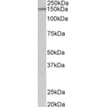 Western Blot - Anti-PCDH17 Antibody (A85011) - Antibodies.com