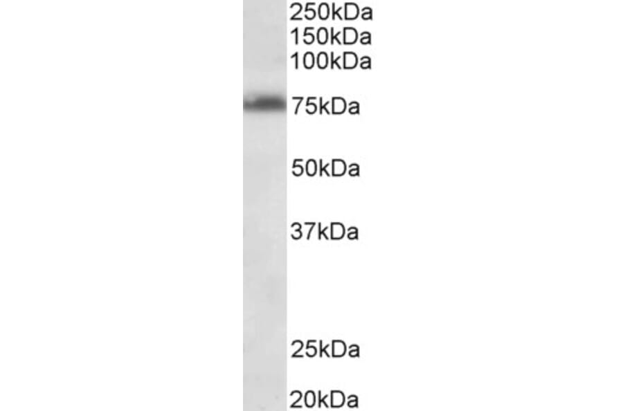 Western Blot - Anti-DENTT Antibody (A85014) - Antibodies.com