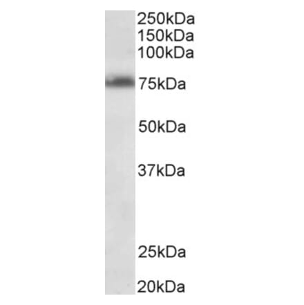 Western Blot - Anti-DENTT Antibody (A85014) - Antibodies.com