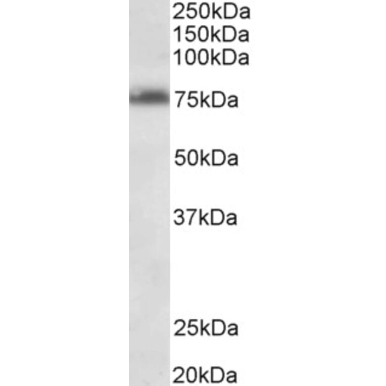 Western Blot - Anti-DENTT Antibody (A85014) - Antibodies.com