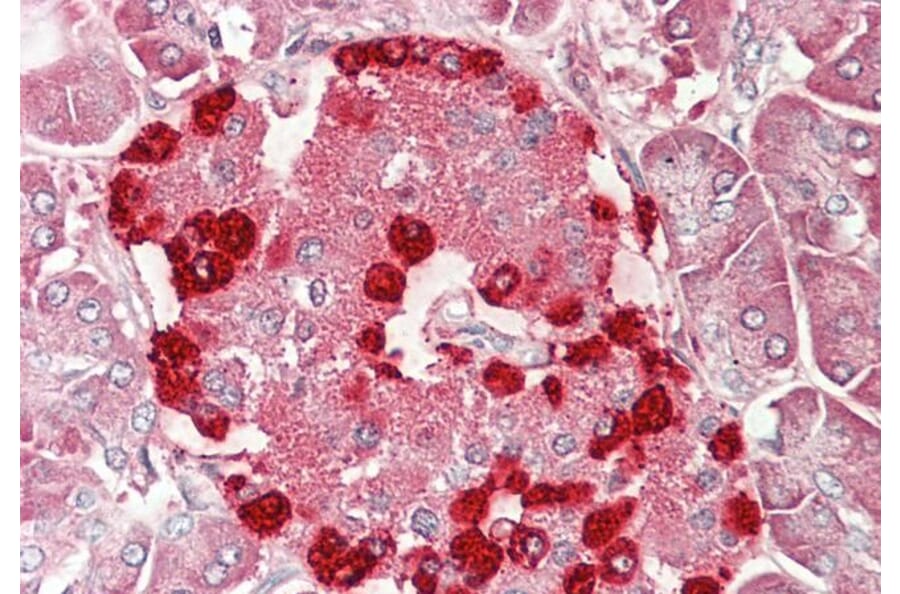 Immunohistochemistry - Anti-DENTT Antibody (A85014) - Antibodies.com