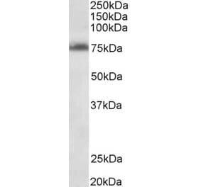 Western Blot - Anti-TSPYL2 Antibody (A85014) - Antibodies.com