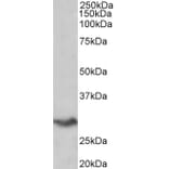 Western Blot - Anti-B7H4 Antibody (A85015) - Antibodies.com