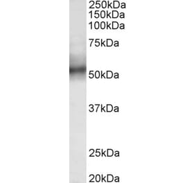 Western Blot - Anti-TRIM11 Antibody (A85016) - Antibodies.com