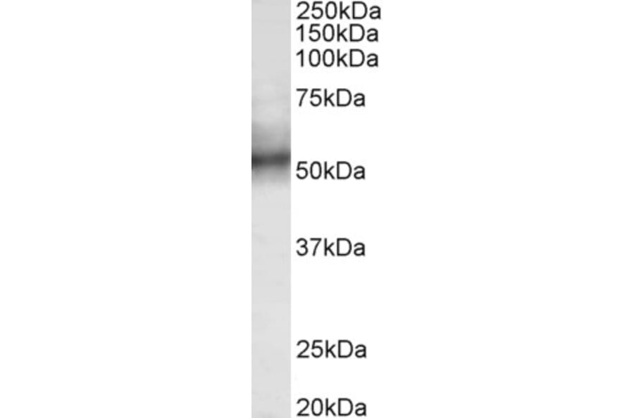 Western Blot - Anti-TRIM11 Antibody (A85016) - Antibodies.com