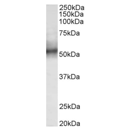 Western Blot - Anti-TRIM11 Antibody (A85016) - Antibodies.com