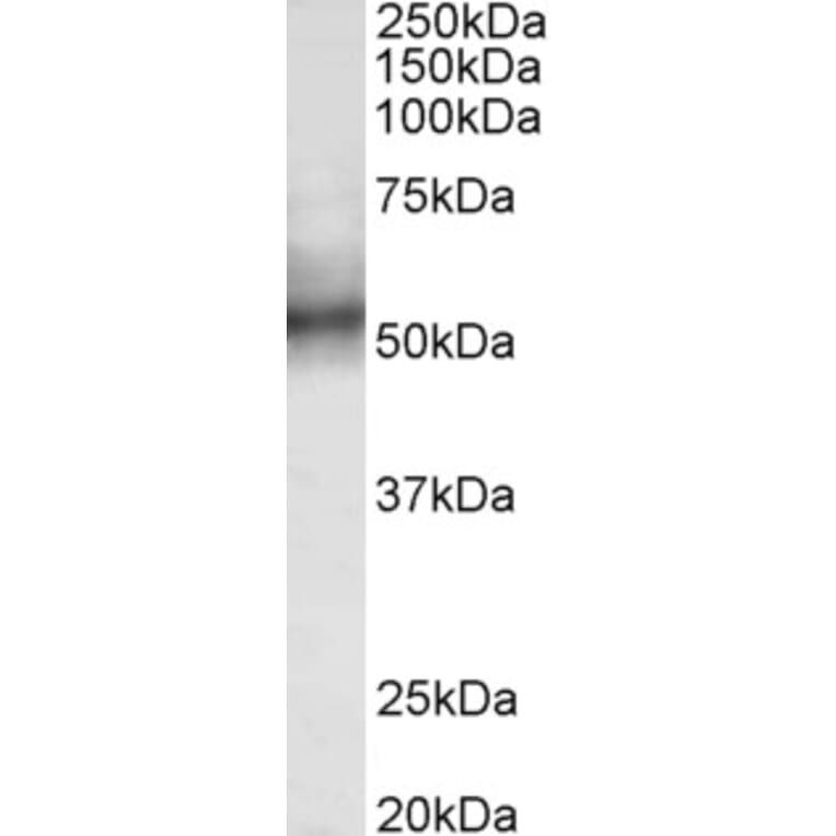 Western Blot - Anti-TRIM11 Antibody (A85016) - Antibodies.com