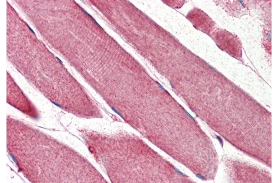 Immunohistochemistry - Anti-TRIM11 Antibody (A85016) - Antibodies.com