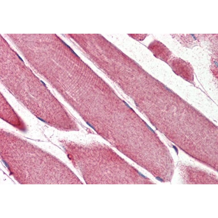 Immunohistochemistry - Anti-TRIM11 Antibody (A85016) - Antibodies.com