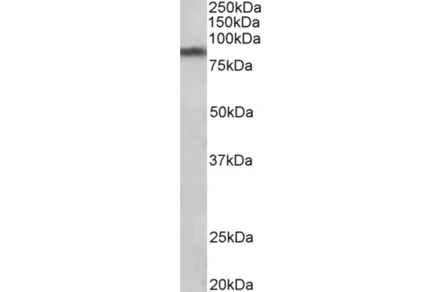 Western Blot - Anti-Dopamine Transporter Antibody (A85019) - Antibodies.com