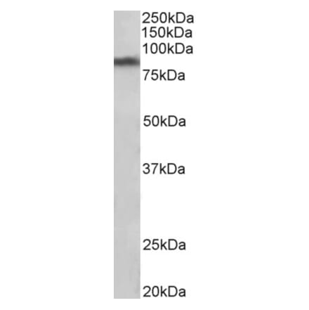 Western Blot - Anti-Dopamine Transporter Antibody (A85019) - Antibodies.com