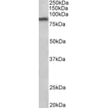 Western Blot - Anti-Dopamine Transporter Antibody (A85019) - Antibodies.com