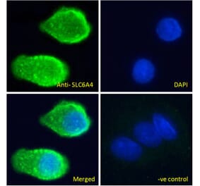 Immunofluorescence - Anti-Serotonin Transporter Antibody (A85020) - Antibodies.com