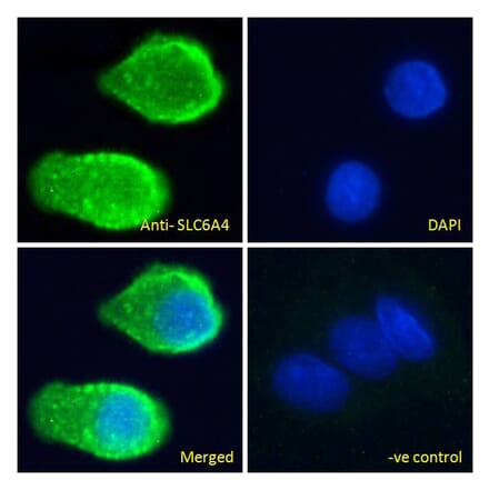 Immunofluorescence - Anti-Serotonin Transporter Antibody (A85020) - Antibodies.com