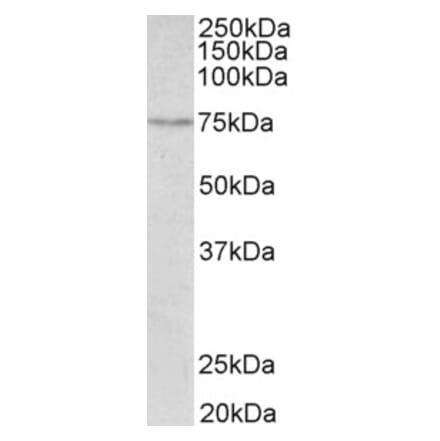 Western Blot - Anti-SLC6A4 Antibody (A85020) - Antibodies.com