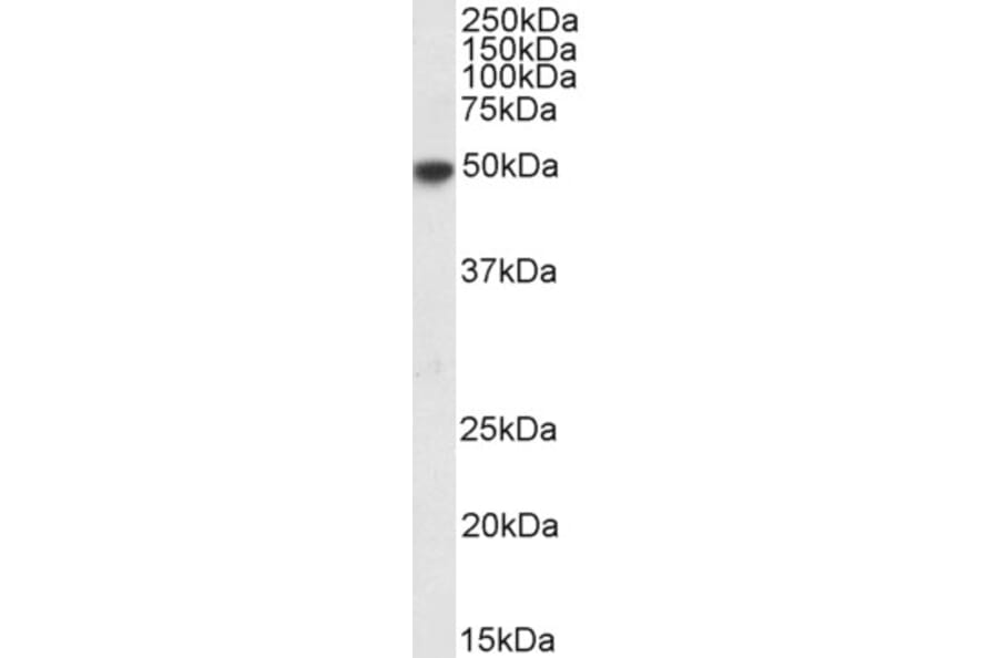 Western Blot - Anti-IRF4 Antibody (A85022) - Antibodies.com