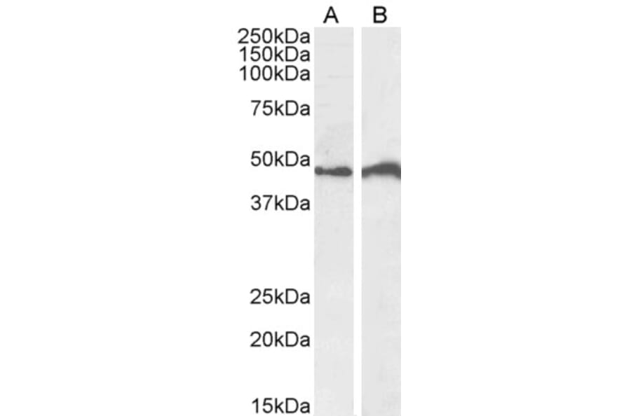 Western Blot - Anti-IRF4 Antibody (A85022) - Antibodies.com