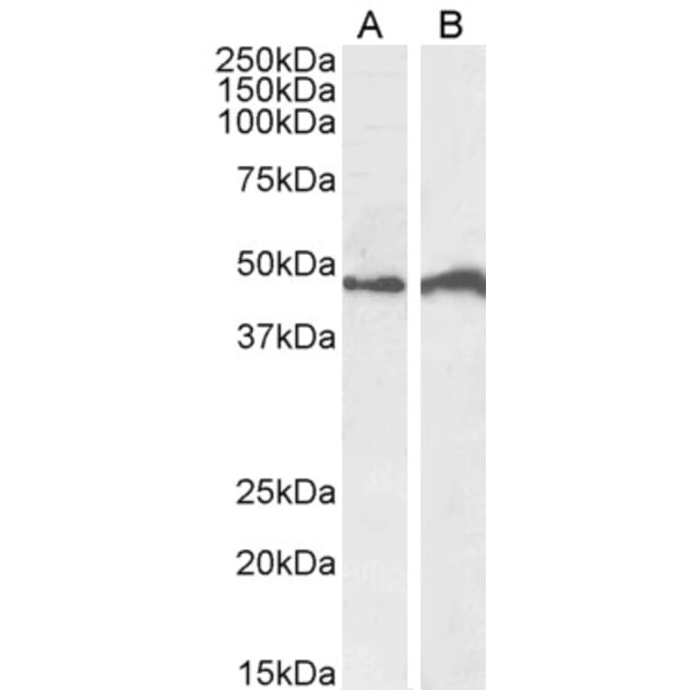 Western Blot - Anti-IRF4 Antibody (A85022) - Antibodies.com