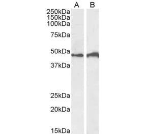 Western Blot - Anti-IRF4 Antibody (A85022)