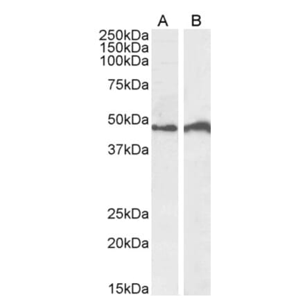 Western Blot - Anti-IRF4 Antibody (A85022)