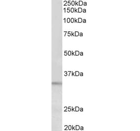 Western Blot - Anti-PI-15 Antibody (A85023) - Antibodies.com