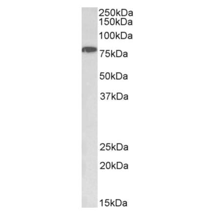 Western Blot - Anti-IKK alpha Antibody (A85025) - Antibodies.com