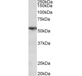 Western Blot - Anti-TNF Receptor I Antibody (A85026) - Antibodies.com