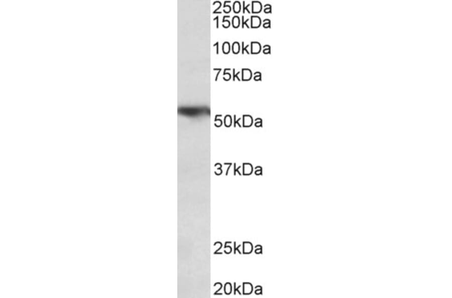 Western Blot - Anti-TNF Receptor I Antibody (A85026) - Antibodies.com