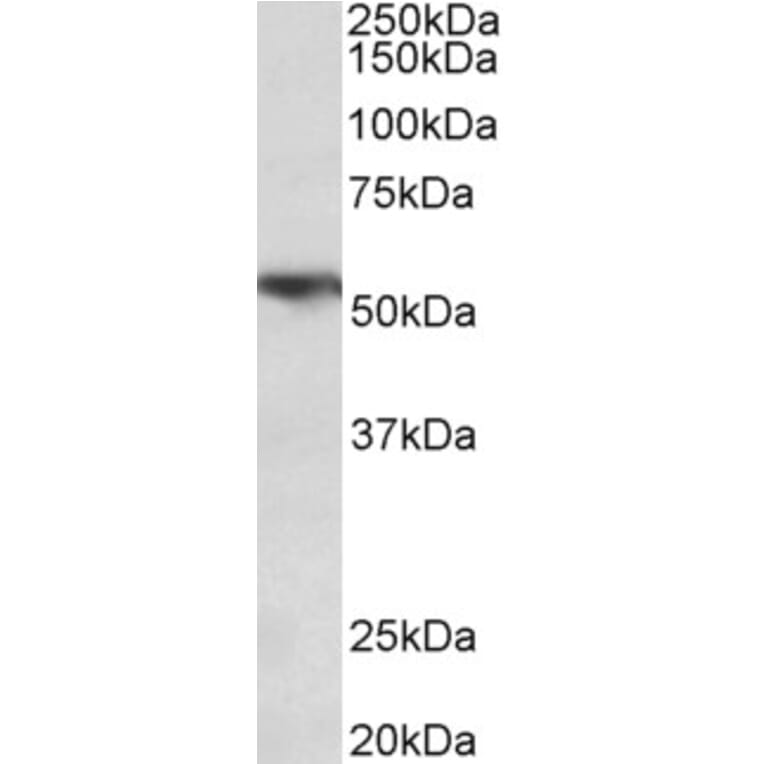 Western Blot - Anti-TNF Receptor I Antibody (A85026) - Antibodies.com