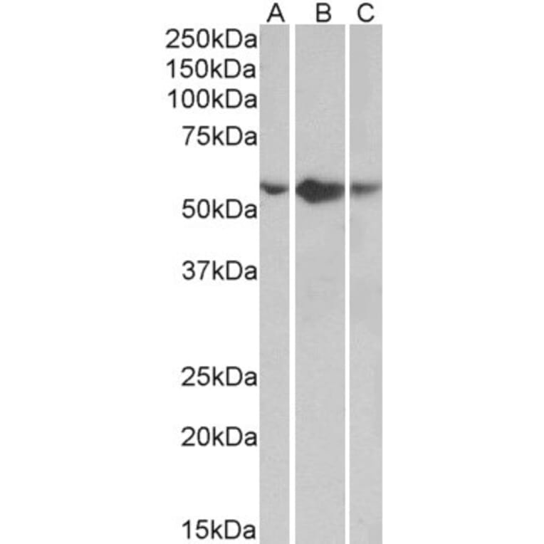Western Blot - Anti-TNF Receptor I Antibody (A85026) - Antibodies.com