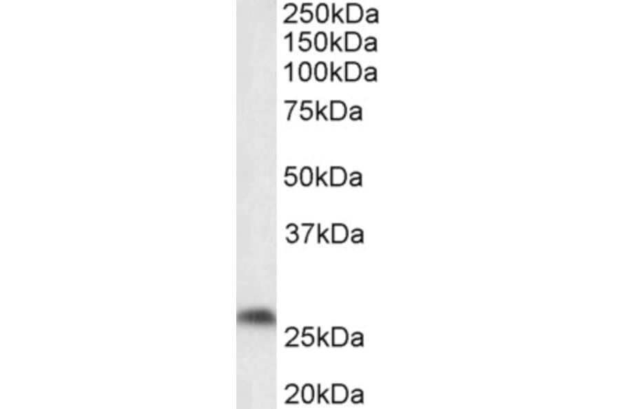 Western Blot - Anti-PTGDS Antibody (A85027) - Antibodies.com