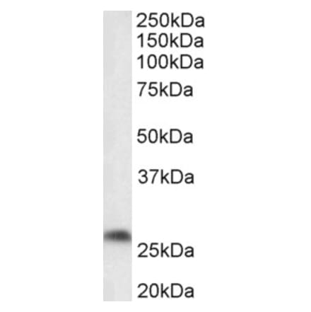 Western Blot - Anti-PTGDS Antibody (A85027) - Antibodies.com