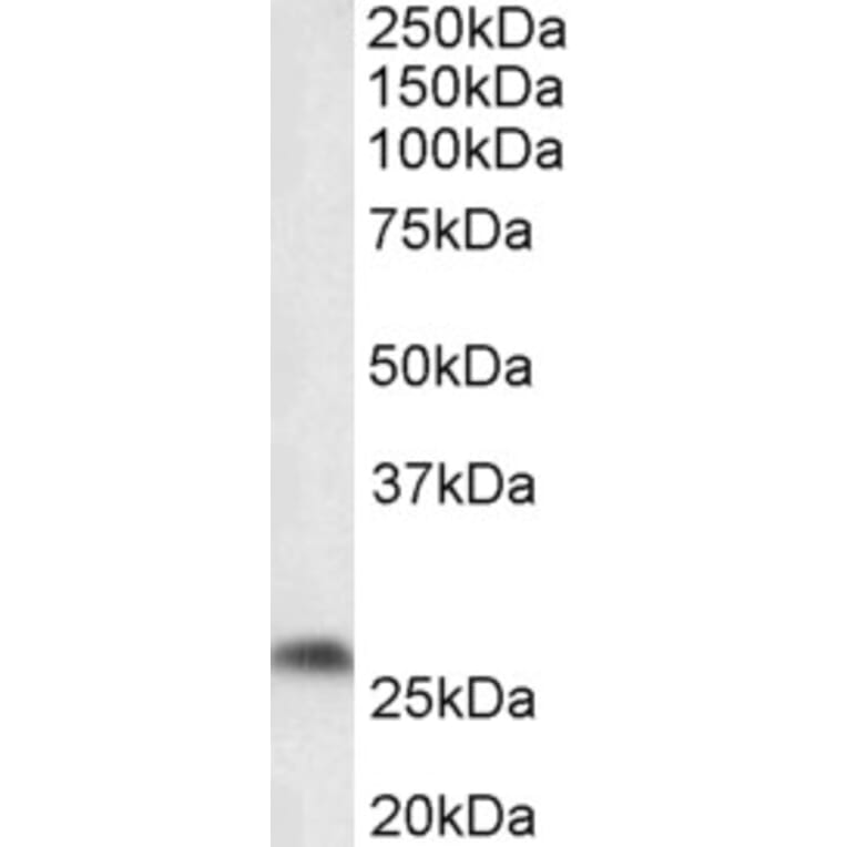 Western Blot - Anti-PTGDS Antibody (A85027) - Antibodies.com