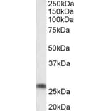 Western Blot - Anti-PTGDS Antibody (A85027) - Antibodies.com