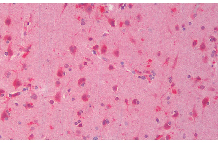 Immunohistochemistry - Anti-Dishevelled/Dvl1 Antibody (A85032) - Antibodies.com