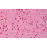 Immunohistochemistry - Anti-Dishevelled/Dvl1 Antibody (A85032) - Antibodies.com