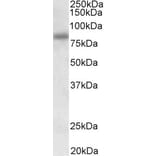Western Blot - Anti-SDCCAG8 Antibody (A85034) - Antibodies.com