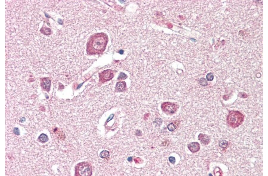 Immunohistochemistry - Anti-SDCCAG8 Antibody (A85034) - Antibodies.com