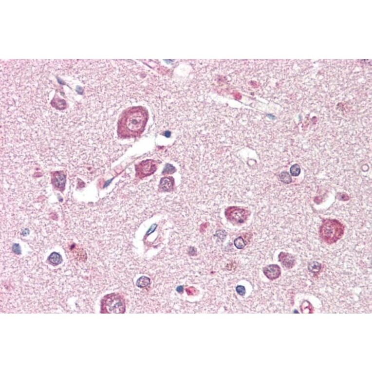 Immunohistochemistry - Anti-SDCCAG8 Antibody (A85034) - Antibodies.com
