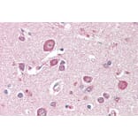 Immunohistochemistry - Anti-SDCCAG8 Antibody (A85034) - Antibodies.com