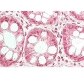 Immunohistochemistry - Anti-TRPC6 Antibody (A85037) - Antibodies.com