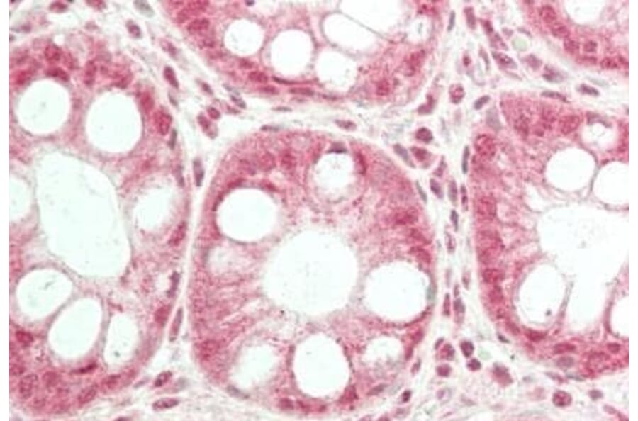 Immunohistochemistry - Anti-TRPC6 Antibody (A85037) - Antibodies.com