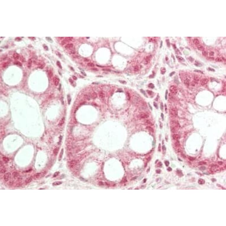 Immunohistochemistry - Anti-TRPC6 Antibody (A85037) - Antibodies.com
