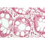 Immunohistochemistry - Anti-TRPC6 Antibody (A85037) - Antibodies.com